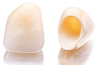 Dental Crowns and Dental Bridges